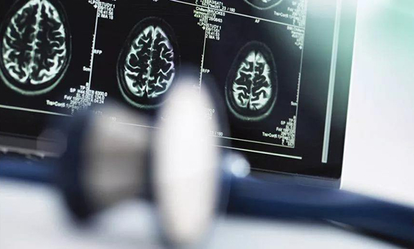 AI醫(yī)療目前首要任務(wù)是解決醫(yī)療難題，而不是鼓吹噱頭-鋒巢網(wǎng)